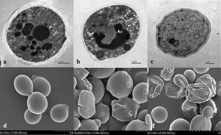 Yeast autolysis stages